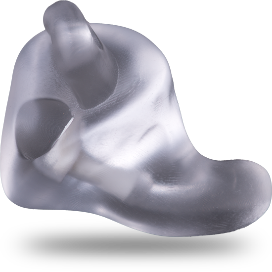 passtop-or-resine-interson